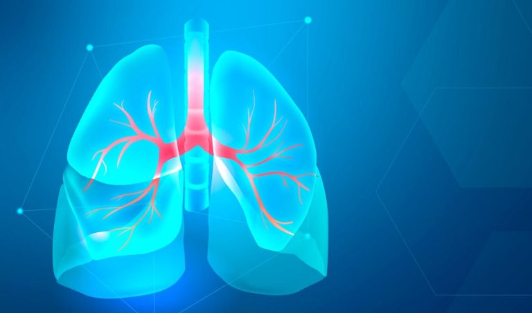 Video Assisted Thoracic Surgery